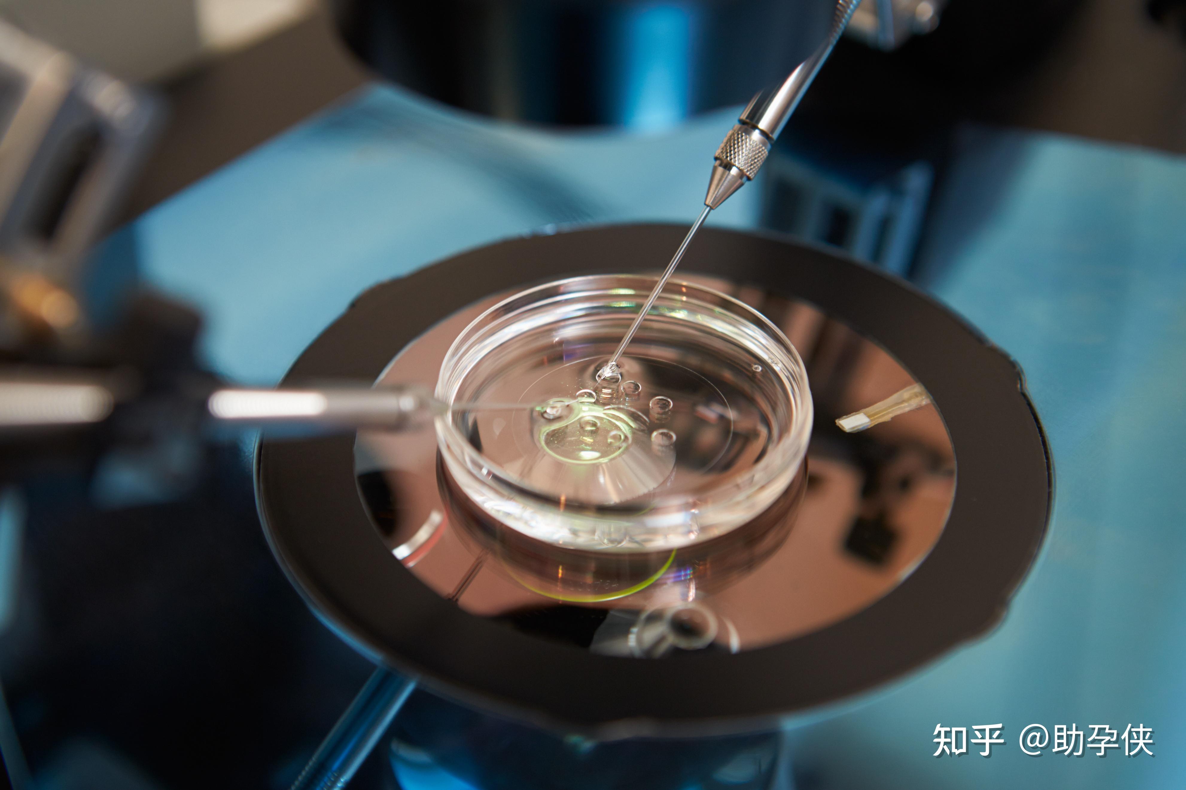 30岁女性试管婴儿成功率分析